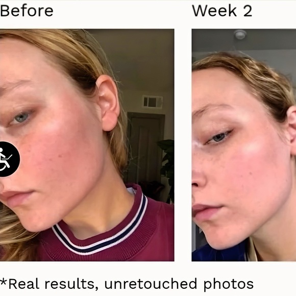 Saturday Skin Pretty Pop Probiotic Power Whipped Cream - Picture 11 of 11